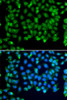 Immunofluorescence analysis of MCF-7 cells using RNF8 Polyclonal Antibody