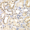 Immunohistochemistry of paraffin-embedded Human kidney using ZNF264 Polyclonal Antibody at dilution of  1:100 (40x lens).