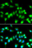 Immunofluorescence analysis of HeLa cells using AKAP5 Polyclonal Antibody at dilution of  1:100. Blue: DAPI for nuclear staining.
