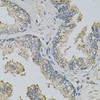 Immunohistochemistry of paraffin-embedded Human prostate using PSAT1 Polyclonal Antibody at dilution of  1:100 (40x lens).