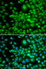 Immunofluorescence analysis of MCF-7 cells using SETD5 Polyclonal Antibody