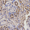 Immunohistochemistry of paraffin-embedded Rat kidney using EPHX2 Polyclonal Antibody at dilution of  1:200 (40x lens).