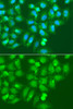 Immunofluorescence analysis of A549 cells using AMY2B Polyclonal Antibody