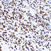 Immunohistochemistry of paraffin-embedded Human appendix using Acetyl-Histone H4-K12 Polyclonal Antibody at dilution of  1:200 (40x lens).