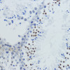Immunohistochemistry of paraffin-embedded Mouse testis using Acetyl-Histone H4-K12 Polyclonal Antibody at dilution of  1:200 (40x lens).