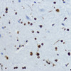 Immunohistochemistry of paraffin-embedded Mouse spinal cord using Acetyl-Histone H4-K12 Polyclonal Antibody at dilution of  1:200 (40x lens).