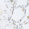 Immunohistochemistry of paraffin-embedded Human lung using ATP2A3 Polyclonal Antibody at dilution of  1:100 (40x lens).