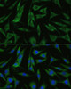 Immunofluorescence analysis of L929 cells using RHBDD1 Polyclonal Antibody at dilution of  1:100 (40x lens). Blue: DAPI for nuclear staining.