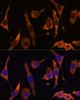 Immunofluorescence analysis of L929 cells using RPL36AL Polyclonal Antibody at dilution of  1:100 (40x lens). Blue: DAPI for nuclear staining.