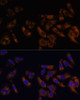 Immunofluorescence analysis of U-2 OS cells using RPL36AL Polyclonal Antibody at dilution of  1:100 (40x lens). Blue: DAPI for nuclear staining.