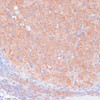 Immunohistochemistry of paraffin-embedded Rat ovary using LRP1 Polyclonal Antibody at dilution of  1:100 (40x lens).