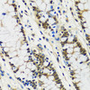 Immunohistochemistry of paraffin-embedded Human colon using CCDC59 Polyclonal Antibody at dilution of  1:100 (40x lens).