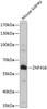 Western blot analysis of extracts of Mouse kidney using ZNF416 Polyclonal Antibody at dilution of 1:1000.