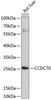 Western blot analysis of extracts of Rat liver using CCDC70 Polyclonal Antibody at dilution of 1:3000.