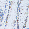 Immunohistochemistry of paraffin-embedded Human colon using CA13 Polyclonal Antibody at dilution of  1:100 (40x lens).