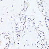 Immunohistochemistry of paraffin-embedded Human breast using BRIX1 Polyclonal Antibody at dilution of  1:100 (40x lens).