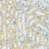 Immunohistochemistry of paraffin-embedded Mouse kidney using CAMK1 Polyclonal Antibody at dilution of  1:100 (40x lens).