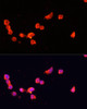 Immunofluorescence analysis of SH-SY5Y cells using CDK5R1 Polyclonal Antibody at dilution of  1:100. Blue: DAPI for nuclear staining.