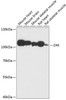 Western blot analysis of extracts of various cell lines using ZAK Polyclonal Antibody at dilution of 1:3000.