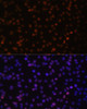 Immunofluorescence analysis of C6 cells using HTATSF1 Polyclonal Antibody at dilution of  1:100. Blue: DAPI for nuclear staining.