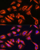 Immunofluorescence analysis of U2OS cells using DPP4 Polyclonal Antibody at dilution of  1:100. Blue: DAPI for nuclear staining.