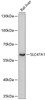 Western blot analysis of extracts of Rat liver using SLC47A1 Polyclonal Antibody at dilution of 1:1000.