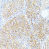 Immunohistochemistry of paraffin-embedded Rat ovary using SLC7A2 Polyclonal Antibody at dilution of  1:100 (40x lens).