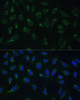 Immunofluorescence analysis of U-2 OS cells using HIGD1A Polyclonal Antibody at dilution of  1:100 (40x lens). Blue: DAPI for nuclear staining.
