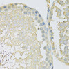 Immunohistochemistry of paraffin-embedded Rat testis using SLC2A9 Polyclonal Antibody at dilution of  1:100 (40x lens).