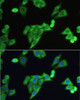 Immunofluorescence analysis of HeLa cells using SLC2A9 Polyclonal Antibody at dilution of  1:100. Blue: DAPI for nuclear staining.
