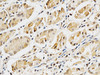 Immunohistochemistry of paraffin-embedded Human stomach using LGALS3 Polyclonal Antibody at dilution of  1:200 (40x lens).