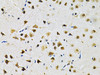 Immunohistochemistry of paraffin-embedded Rat brain using LGALS3 Polyclonal Antibody at dilution of  1:200 (40x lens).