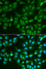 Immunofluorescence analysis of MCF-7 cells using LGALS3 Polyclonal Antibody