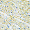 Immunohistochemistry of paraffin-embedded Mouse heart using SLC19A1 Polyclonal Antibody at dilution of  1:100 (40x lens).