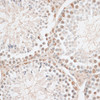 Immunohistochemistry of paraffin-embedded Mouse testis using HMGN1 Polyclonal Antibody at dilution of  1:100 (40x lens).
