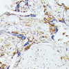 Immunohistochemistry of paraffin-embedded Human placenta using COX15 Polyclonal Antibody at dilution of  1:100 (40x lens).