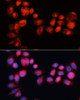 Immunofluorescence analysis of HeLa cells using ABCB7 Polyclonal Antibody at dilution of  1:100 (40x lens). Blue: DAPI for nuclear staining.