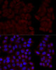 Immunofluorescence analysis of HeLa cells using CALM1 Polyclonal Antibody at dilution of  1:100 (40x lens). Blue: DAPI for nuclear staining.