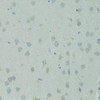 Immunohistochemistry of paraffin-embedded Rat brain using SMAD6 Polyclonal Antibody at dilution of  1:100 (40x lens).