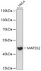 Western blot analysis of extracts of HeLa cells using MAP2K2 Polyclonal Antibody at dilution of 1:1000.