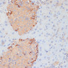 Immunohistochemistry of paraffin-embedded Mouse pancreas using PTPRN2 Polyclonal Antibody at dilution of  1:100 (40x lens).