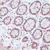 Immunohistochemistry of paraffin-embedded Human colon using S100A5 Polyclonal Antibody at dilution of  1:100 (40x lens).