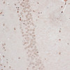 Immunohistochemistry of paraffin-embedded Mouse brain using ZNF177 Polyclonal Antibody at dilution of  1:100 (40x lens).