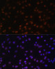 Immunofluorescence analysis of C6 cells using ZNF177 Polyclonal Antibody at dilution of  1:100. Blue: DAPI for nuclear staining.