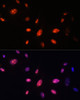 Immunofluorescence analysis of U-2 OS cells using ZNF177 Polyclonal Antibody at dilution of  1:100. Blue: DAPI for nuclear staining.