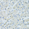 Immunohistochemistry of paraffin-embedded Human liver using SLC5A6 Polyclonal Antibody at dilution of  1:100 (40x lens).