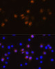 Immunofluorescence analysis of L929 cells using SWAP70 Polyclonal Antibody at dilution of  1:100. Blue: DAPI for nuclear staining.