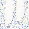 Immunohistochemistry of paraffin-embedded Human colon using BRMS1 Polyclonal Antibody at dilution of  1:100 (40x lens).