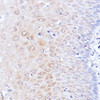 Immunohistochemistry of paraffin-embedded Human esophageal using Polyclonal AntibodyPC1 Polyclonal Antibody at dilution of  1:100 (40x lens).