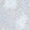 Immunohistochemistry of paraffin-embedded Mouse testis using ZNF446 Polyclonal Antibody at dilution of  1:100 (40x lens).